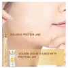 ست لیفتینگ با نخ پروتئین کره ای FaceSculpting - Image 4