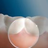 واترجت دندان اورال-بی مدل Waterjet (Idropulsore) - Image 2